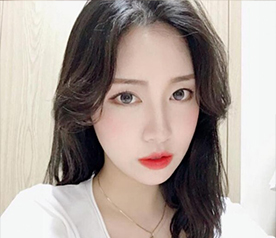 박윤정