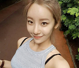 여진  이미지